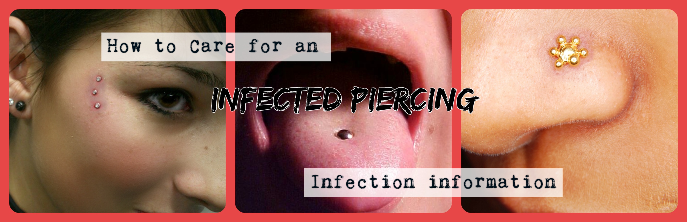 How to Care for an Infected Piercing